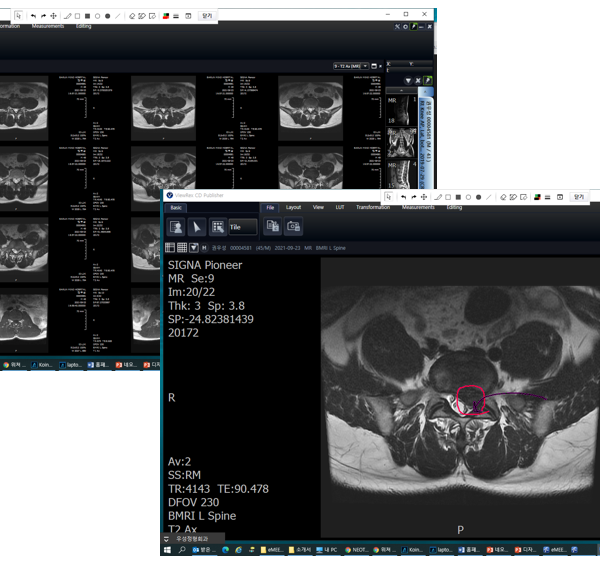 Mri 공유 화면
